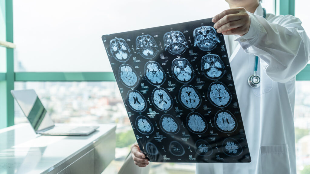 Strong traumatic brain injury attorneys in Charlotte
